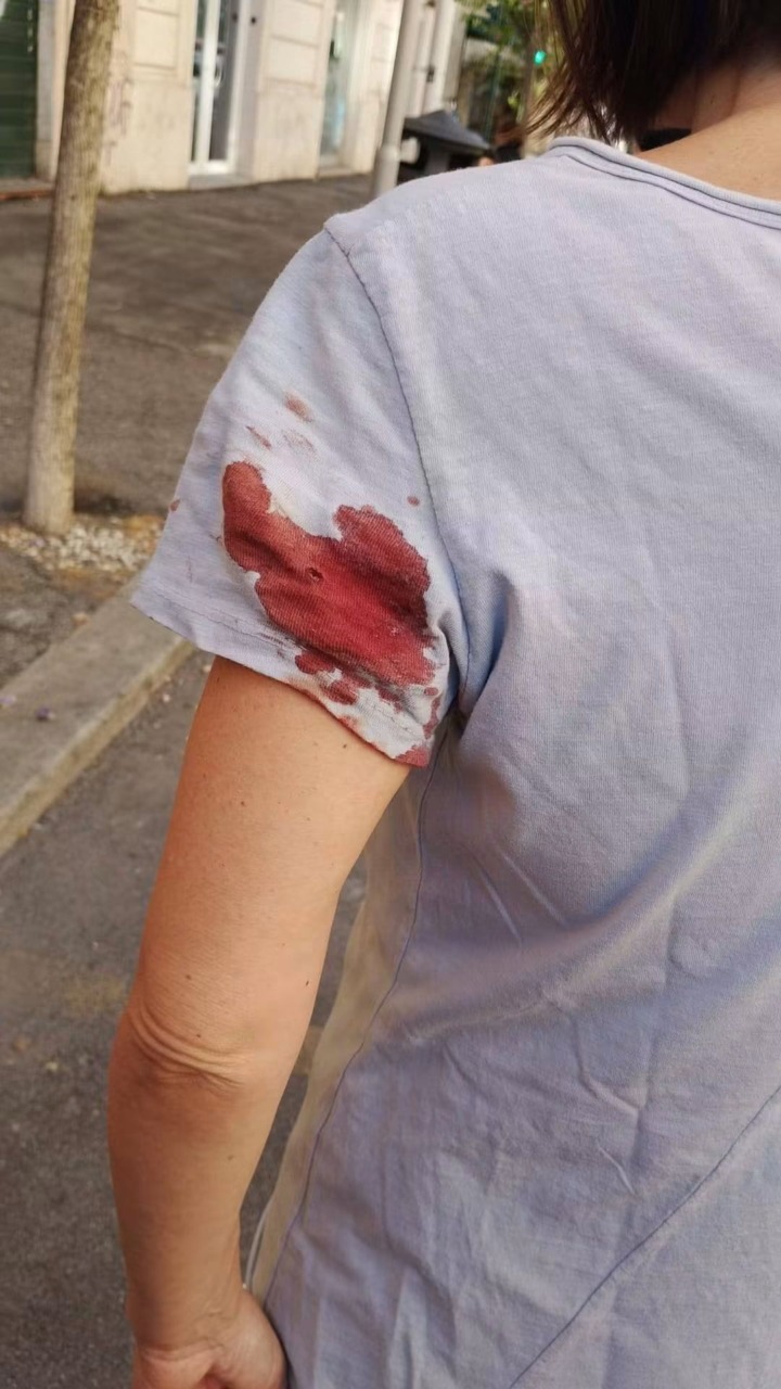 Prati, donna ferita da un piombino: almeno sette episodi