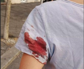 Cristina Stillitano ferita, il sopralluogo del Ris a Roma